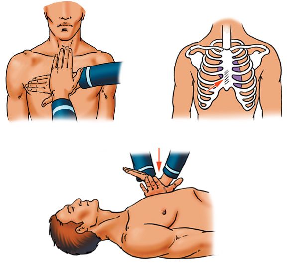 Первая помощь искусственное дыхание и массаж сердца