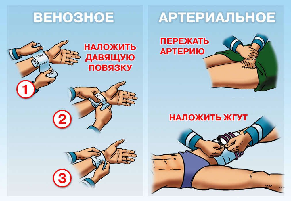 Реферат: Первая медицинская помощь при травмах и несчастных случаях