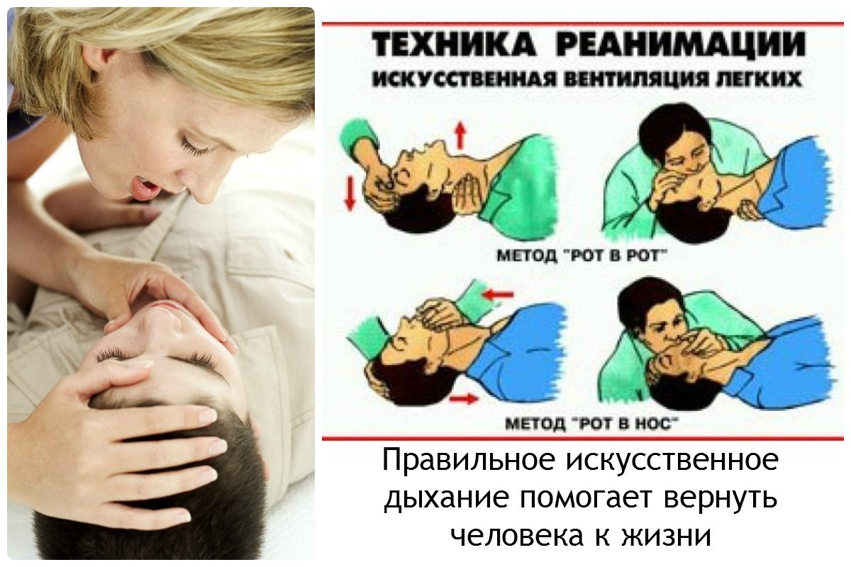 Организационно-правовые аспекты оказания первой помощи - Первая помощь - МЧС России