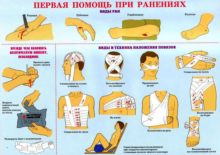 Для чего голову пострадавшего запрокидывают. Смотреть фото Для чего голову пострадавшего запрокидывают. Смотреть картинку Для чего голову пострадавшего запрокидывают. Картинка про Для чего голову пострадавшего запрокидывают. Фото Для чего голову пострадавшего запрокидывают